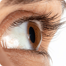 Keratoconus treatment at Local Eye Doctor